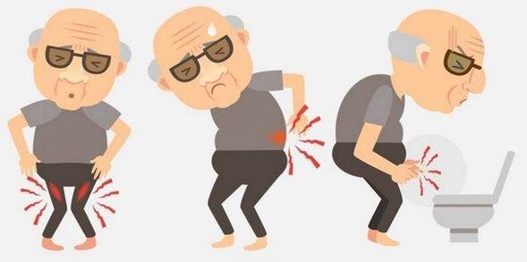 Symptoms of prostatitis